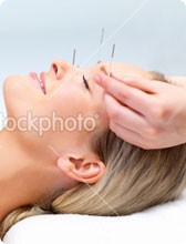 SIMPLY ACUPUNCTURE 5 Element and Traditional Chinese Medicine Leicester 721122 Image 5